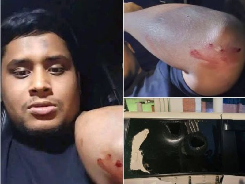 Hasnat Abdullah injured