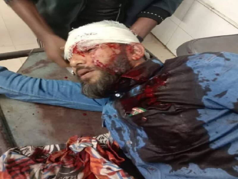 Khulna NCP head shoot